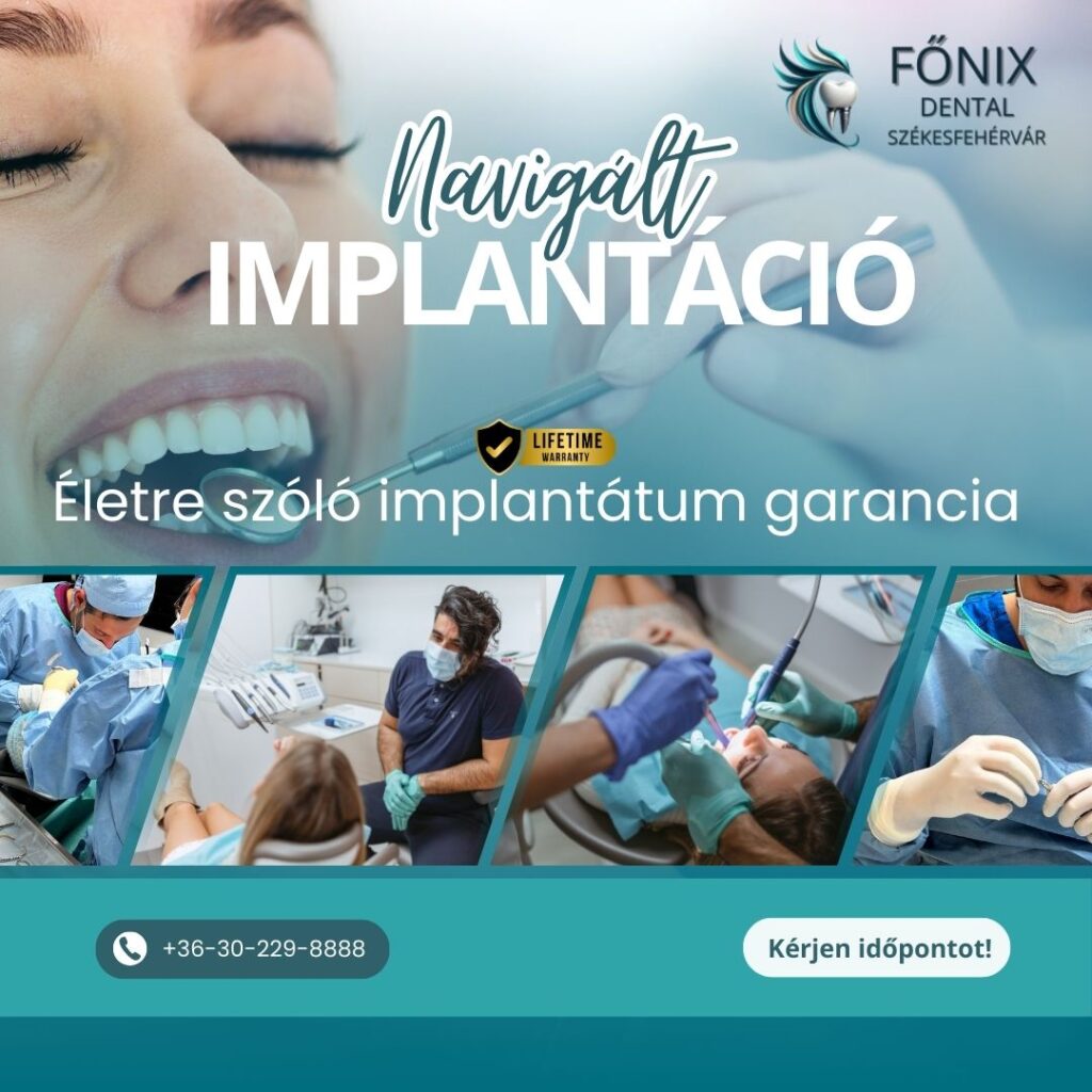 Navigált implantáció garancia (1)