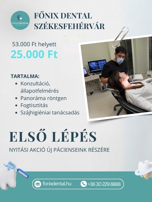 első lépés akció főnix dental székesfehérvár